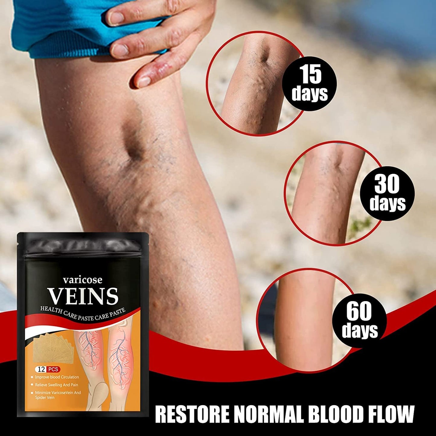 Parche Para Tratamiento de Venas Varices